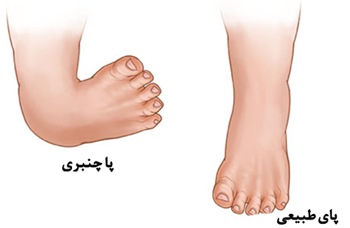 کلاب فوت 